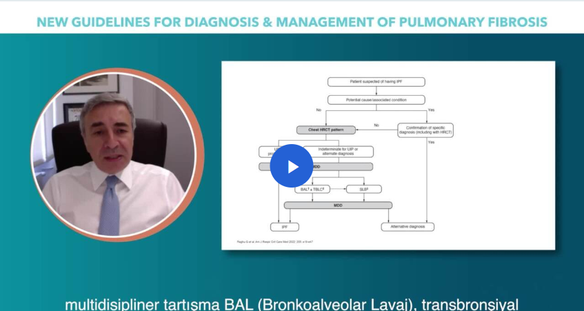 /tr/respiratory/ofev/guideline/dr-luca-richeldi-guncel-ipf-tan-algoritmas