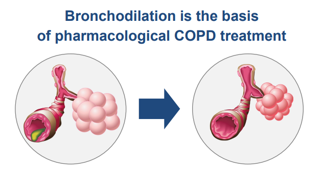 /vn/respiratory/tiotropium-olodaterol/event-slide-deck/prof-roland-buhlres-forum-mar22-are-we-doing-better-two