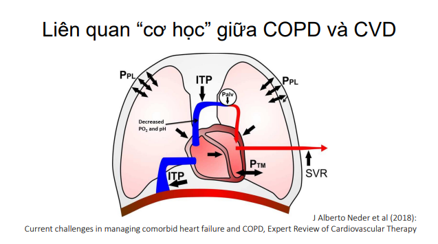 /vn/respiratory/ipratropium-salbutamol/thong-tin-benh-hoc/vn-slide-deckcopd-mac-kem-benh-tim-machnhung-dieu-can-luu-ytsbs-le-khac