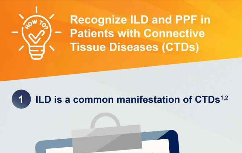 /vn/inflammation/nintedanib/about-pulmonary-fibrosis/how-recognize-ild-ppf-patients-ctd