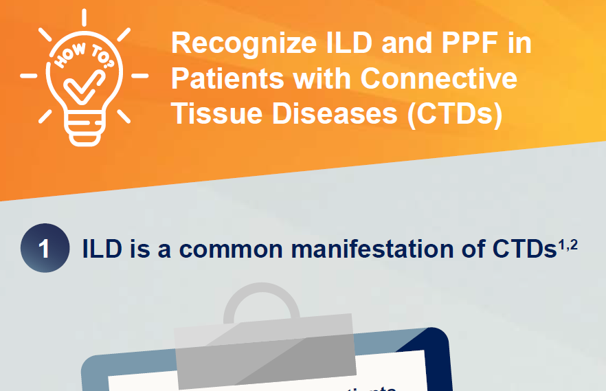 /sg/inflammation/nintedanib/about-pulmonary-fibrosis/how-recognize-ild-ppf-patients-ctd