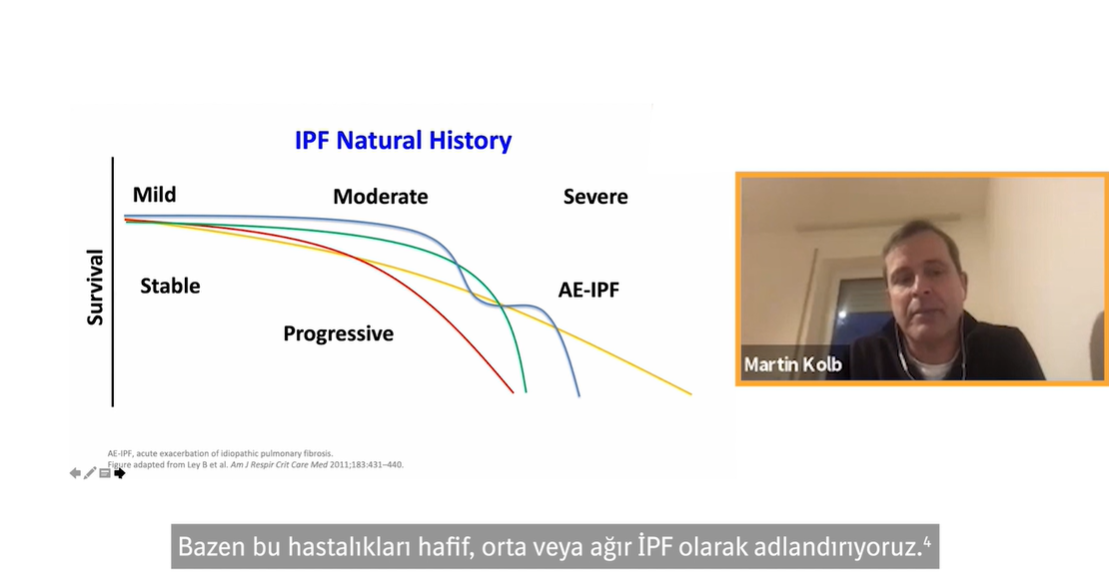 /tr/solunum/ofev/dr-martin-Kolb-ipf/dr-kolb-martin-ipfde-erken-tani-ve-tedavinin-onemi