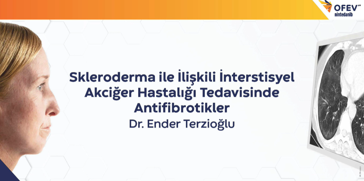 /tr/respiratory/ofev/ssc-ild/dr-ender-terzioglu-skleroderma-iile-iiliskili-iinterstisyel-akciger-hastaligi-tedavisinde