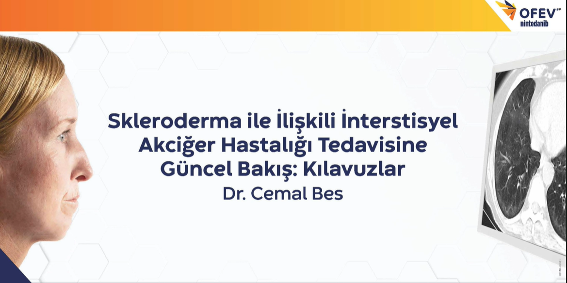 /tr/respiratory/ofev/ssc-ild/dr-cemal-bes-skleroderma-iile-iiliskili-iinterstisyel-akciger-hastaligi-tedavisine-guncel