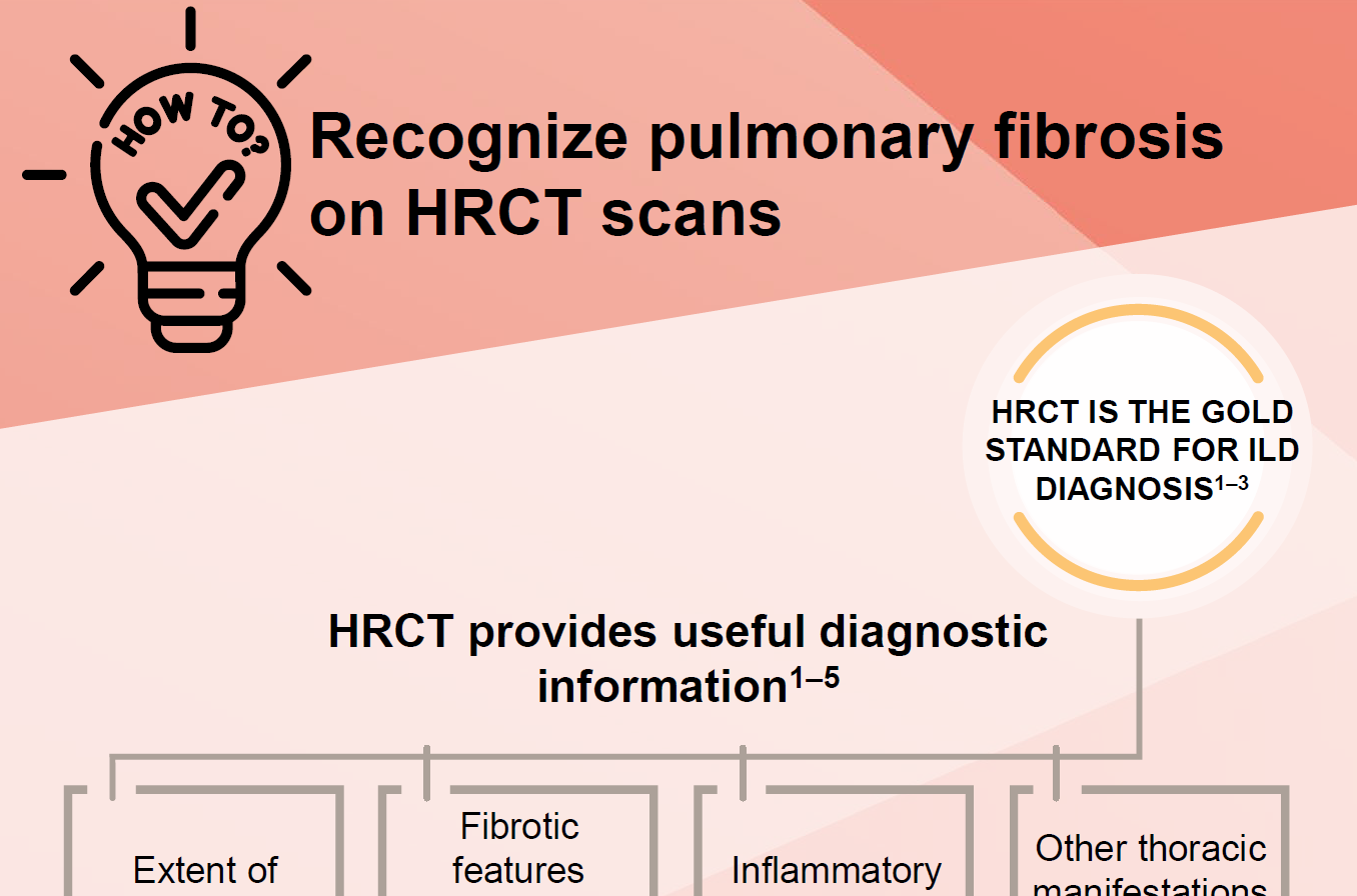 /ph/inflammation/nintedanib/ipf/recognize-pulmonary-fibrosis-hrct-scans