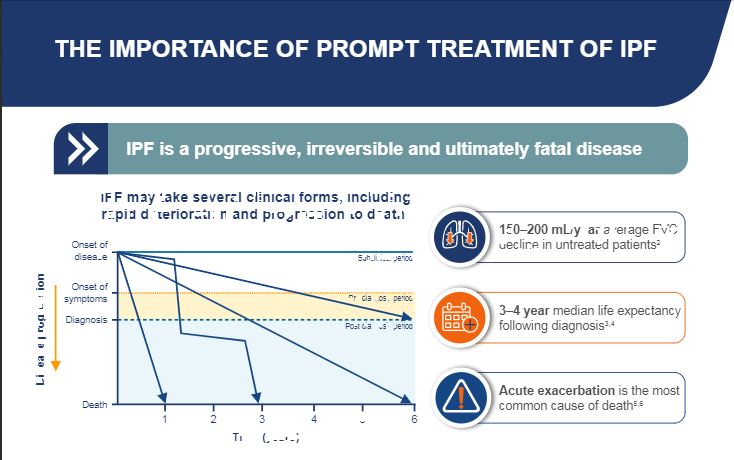 /my/inflammation/nintedanib/about-pulmonary-fibrosis/importance-prompt-treatment-ipf