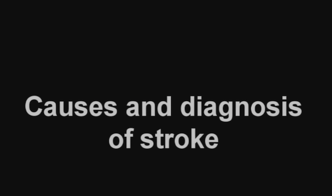 Causes for stroke and its Diagnosis