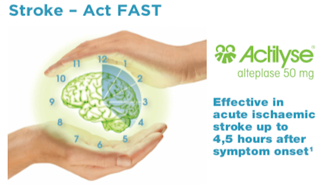 Symptoms of Stroke 