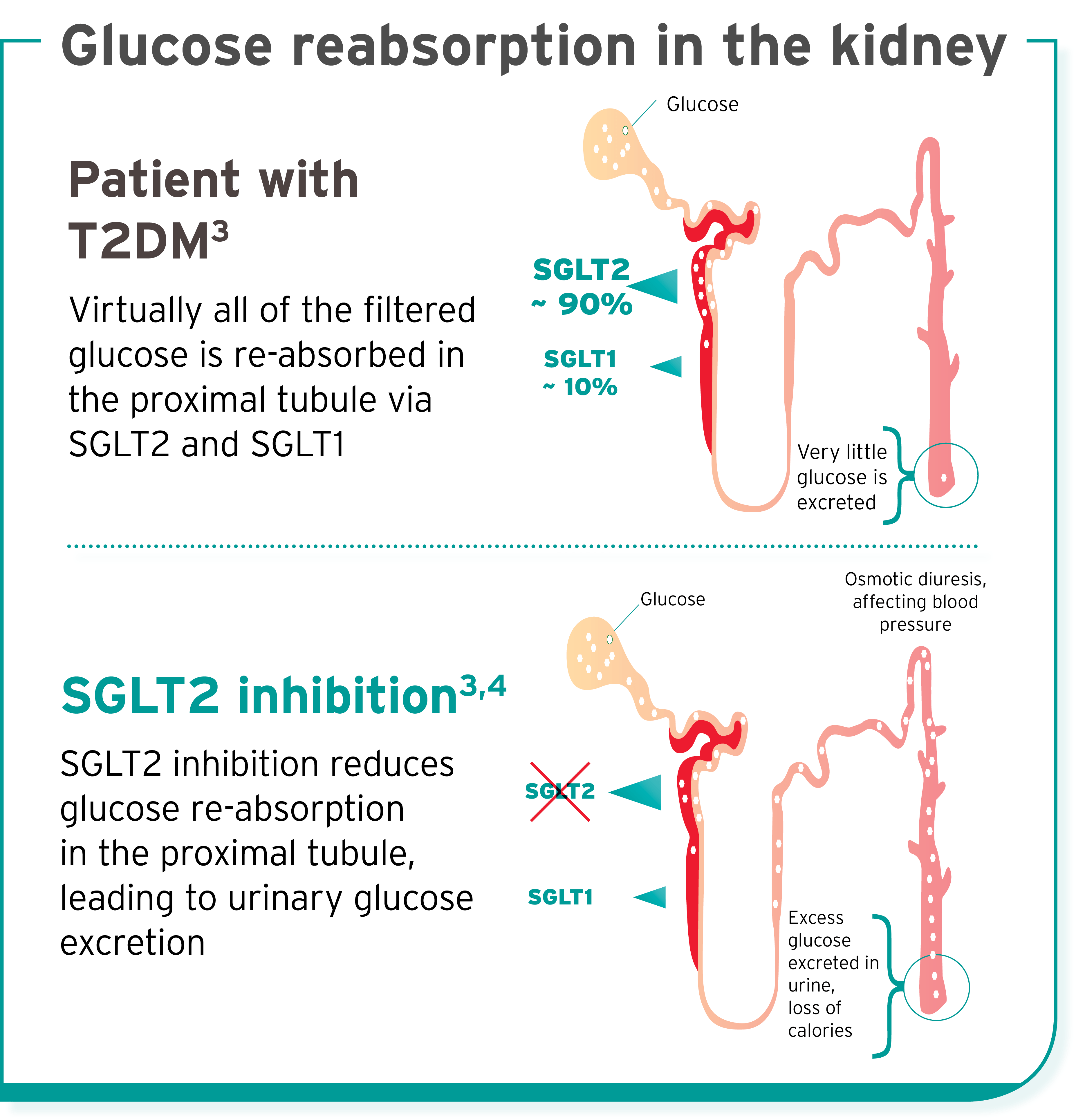 INPULSIS-ON