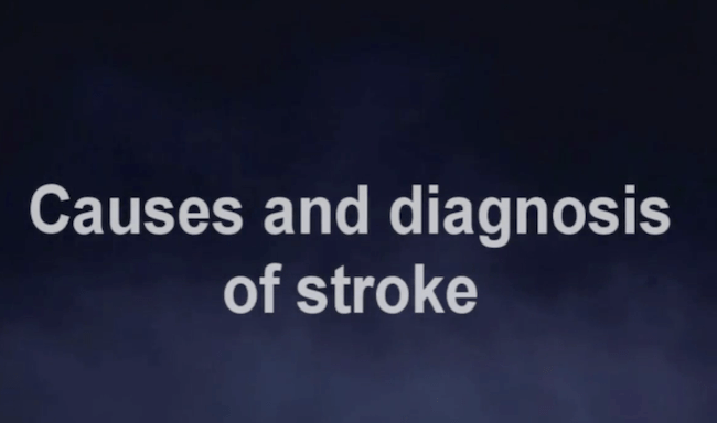 Stroke Causes and Diagnosis