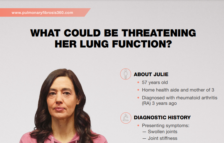 /sg/respiratory/ofev/about-pulmonary-fibrosis/ra-ild-patient-profile-julie