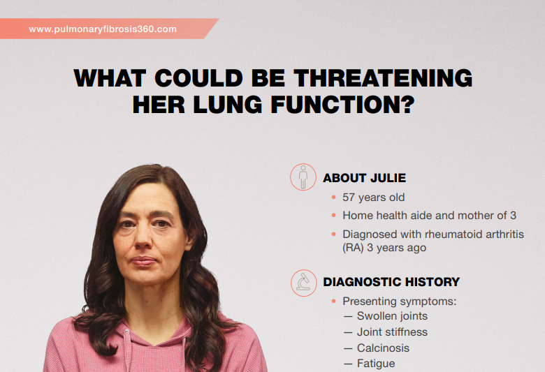 /my/inflammation/nintedanib/about-pulmonary-fibrosis/ra-ild-patient-profile-julie